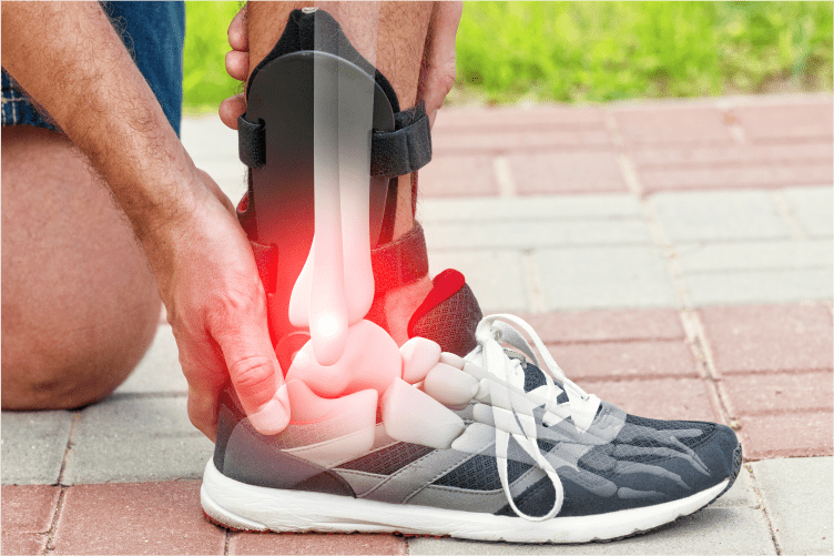 Return to Sports After Arthroscopy
